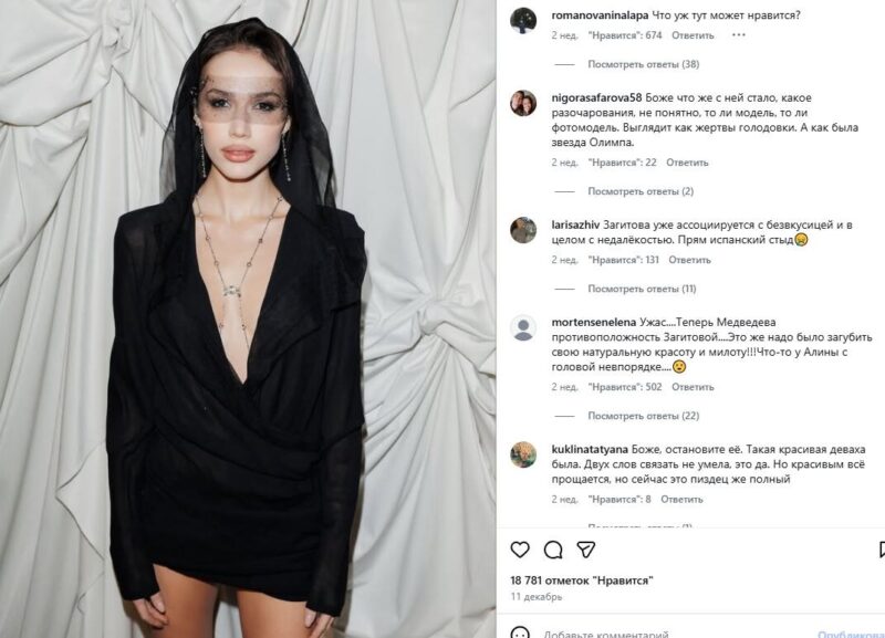Алина Загитова увеличила губы и сменила образ — теперь просит оставить её в покое