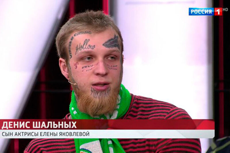 Следы сведения татуировок