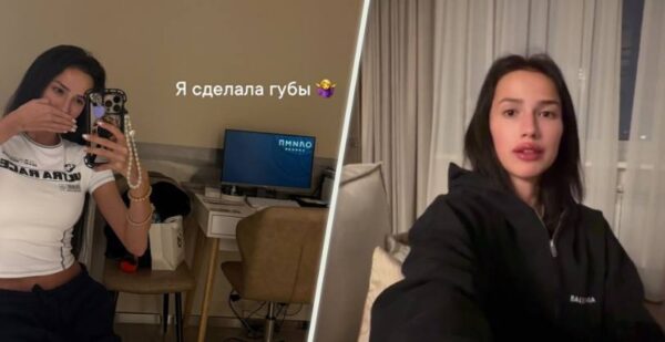 Ничего живого не осталось: что опять стало с лицом Загитовой