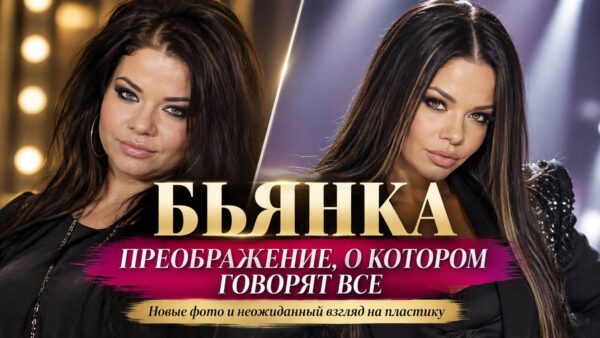 Похудела почти на 40 килограммов и изменила лицо с помощью пластики, но выступает против радикальных операций: как сегодня выглядит Бьянка