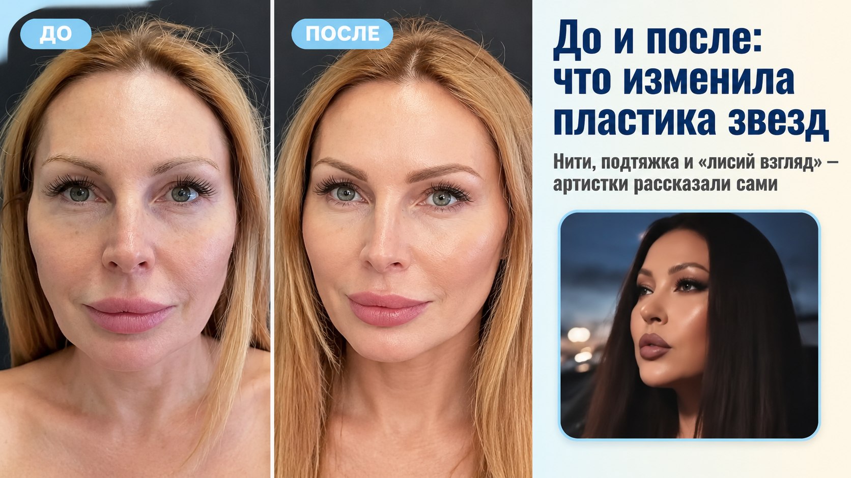 От нитей до «лисьего взгляда»: пять звезд, которые сами рассказали о пластике
