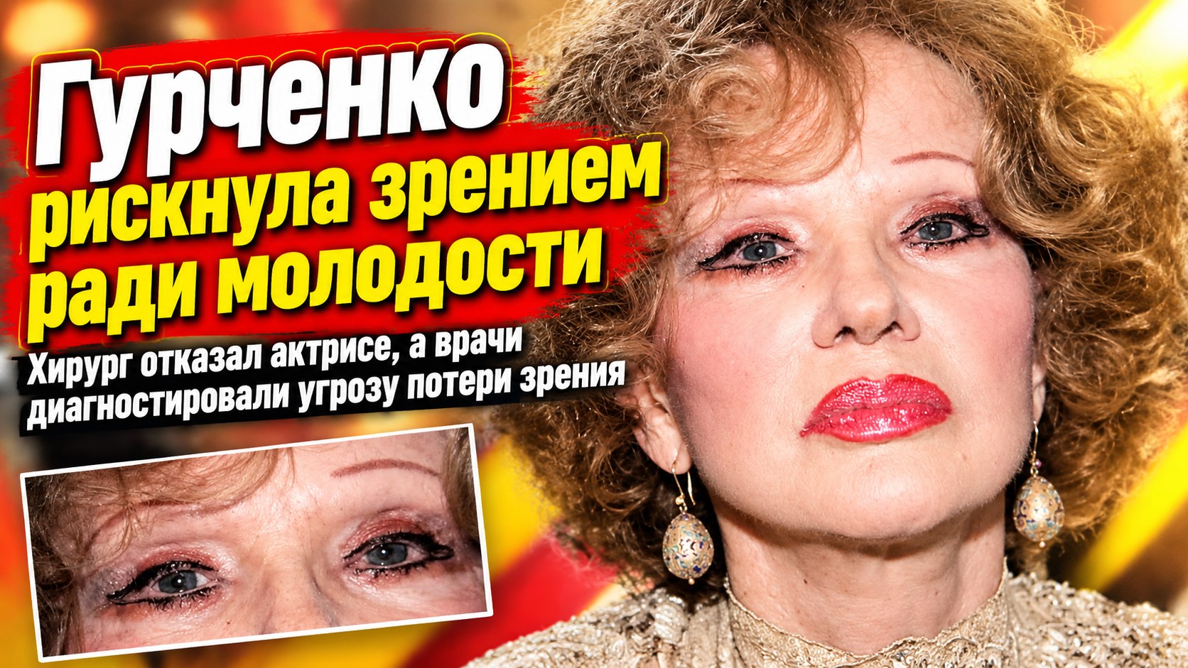 Гурченко боролась с возрастом подтяжками — и оказалась под угрозой потери зрения