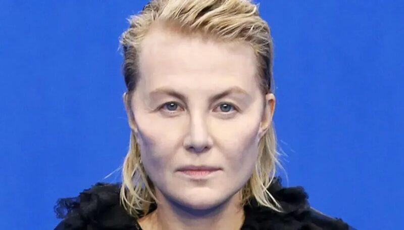 Одно лицо и два разных кадра: 10 российских звёзд без фильтров и ретуши