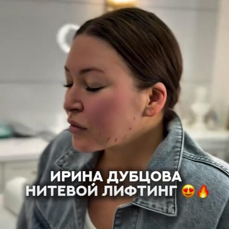 Ирина Дубцова на процедуре