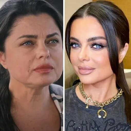 Одно лицо и два разных кадра: 10 российских звёзд без фильтров и ретуши
