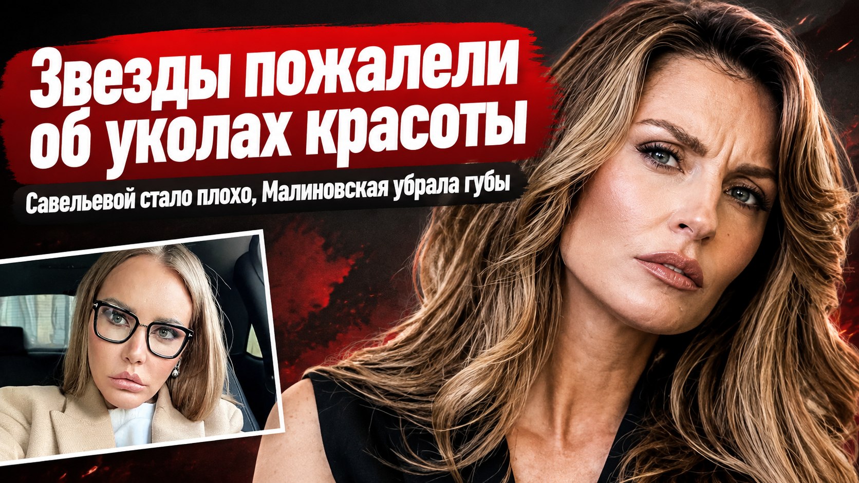 Савельева отказалась от инъекций красоты, а Малиновская жалеет об увеличении губ